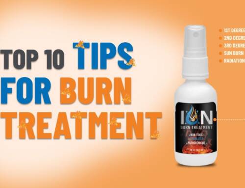 Top 10 Tips for Burn Treatment